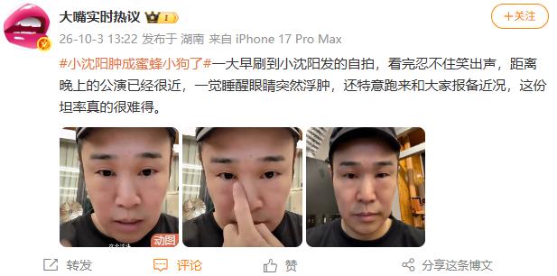 小沈阳一觉睡醒眼睛肿成蜜蜂小狗